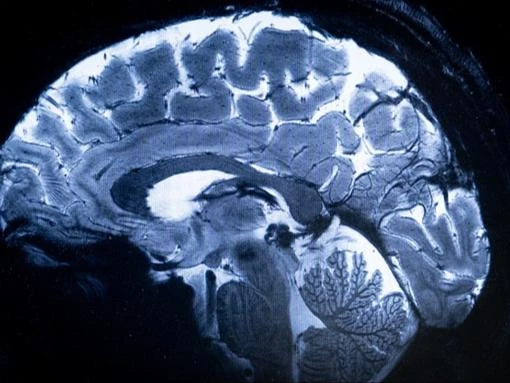 Curiosity could lower chances of dementia in later life