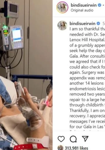 Bindi Irwin 'on road to recovery' after having appendix and 14 endometriosis lesions removed
