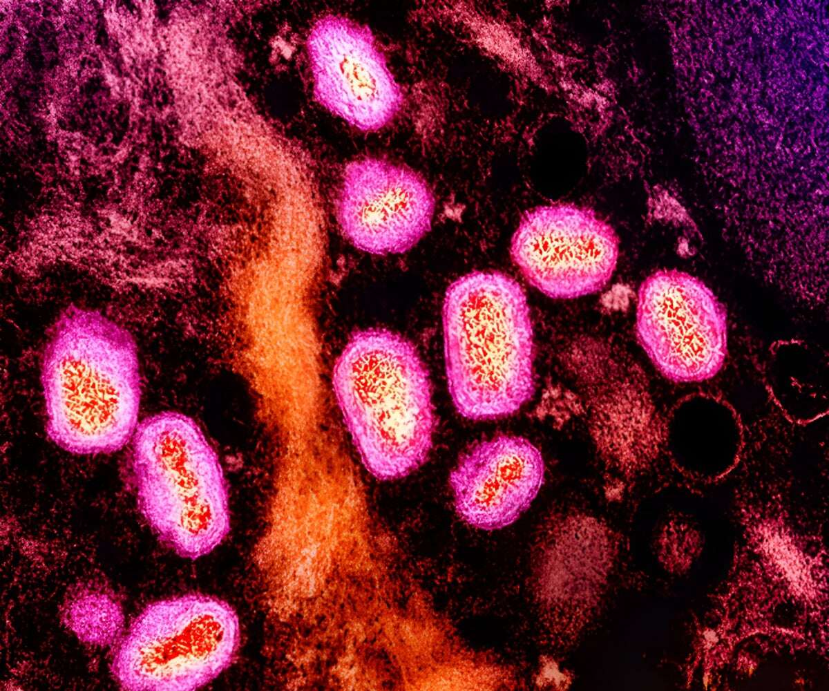 The Virus That Causes Mpox Keeps Getting Better at Spreading in People