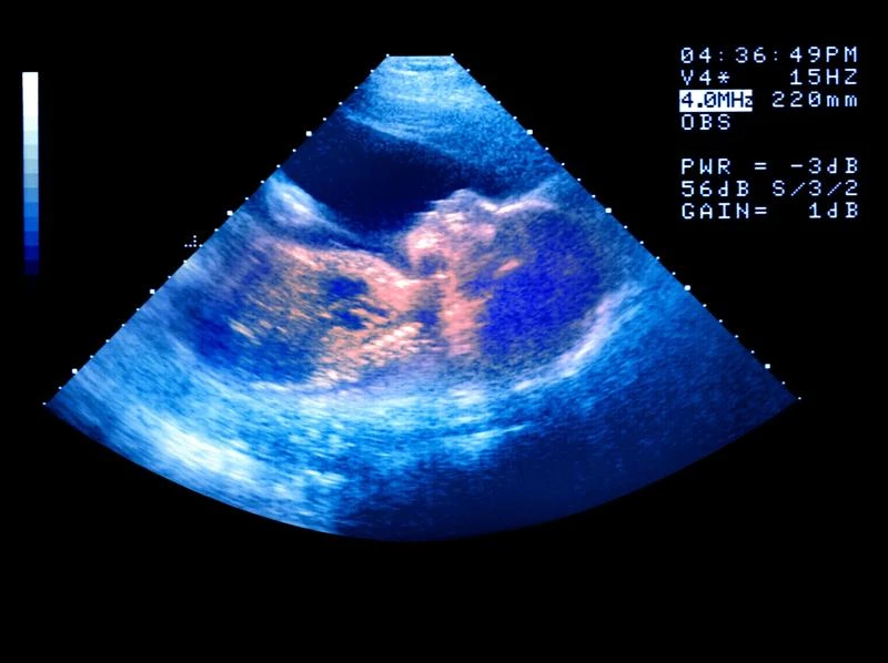Babies may ‘catch’ yawns from their mother in the womb, new study finds