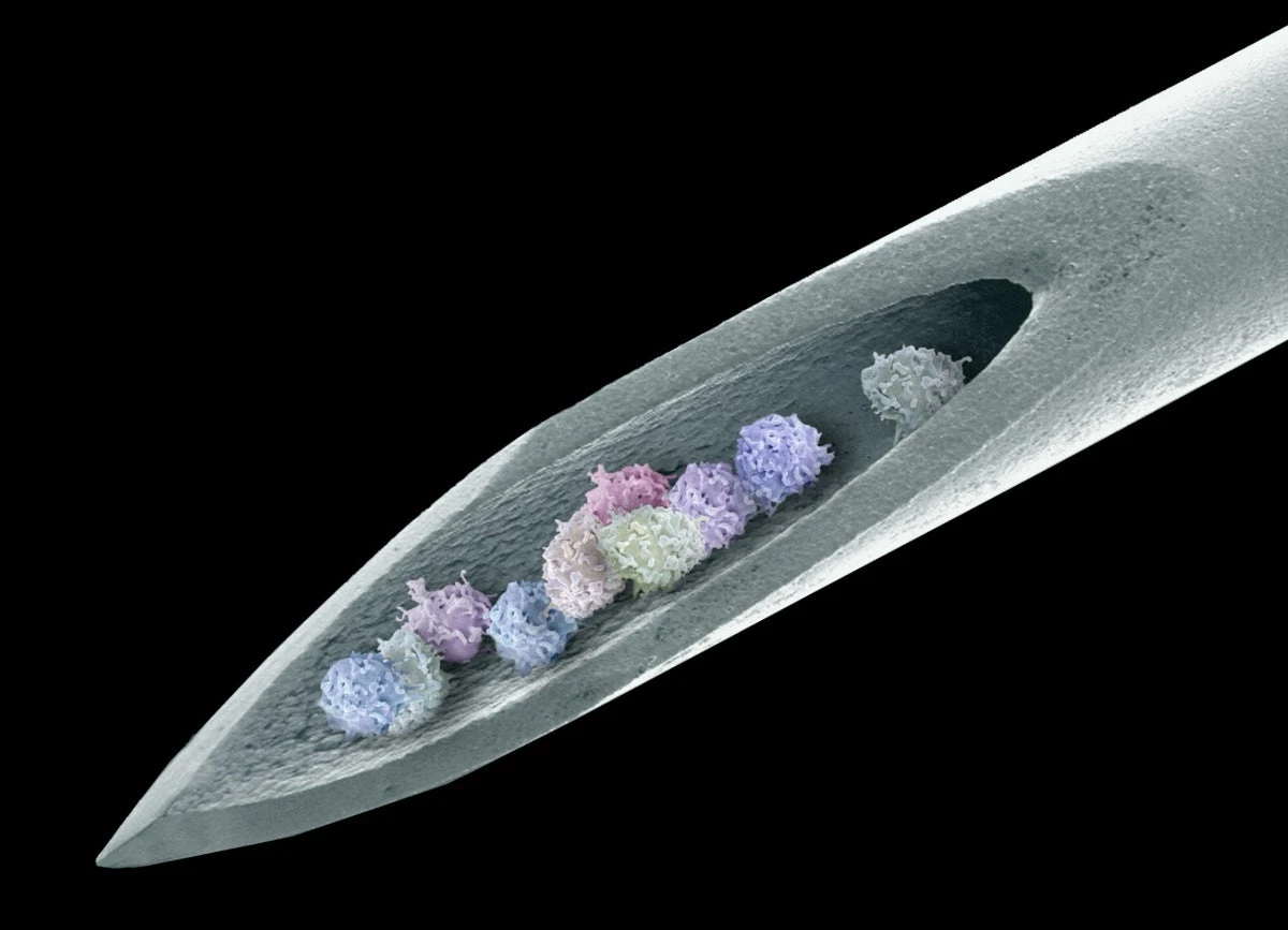 Stem cells banish severe autoimmune disease for 15 years