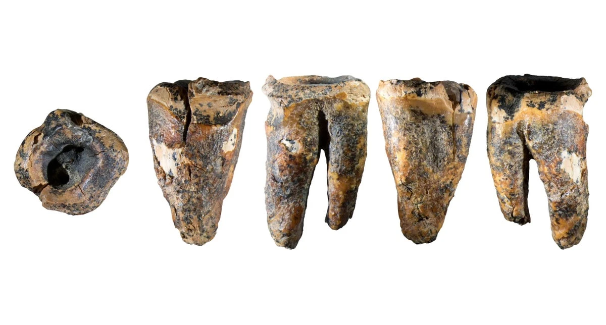 59,000-year-old Neanderthal tooth may be oldest evidence of dentistry