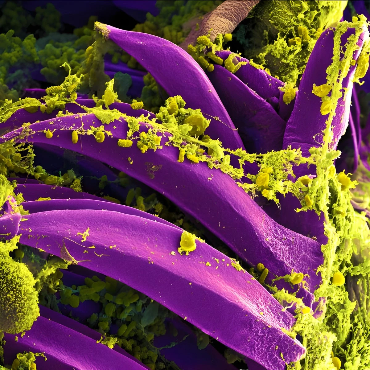 Black Death Plague Bacterium Became Less Fatal thanks to Just One Genetic Tweak