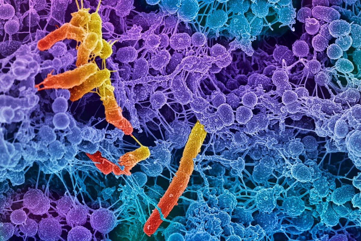 Weird 'Obelisks' Found in Human Gut May be Virus-Like Entity