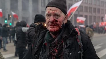 Fotoreporter ranny podczas Marszu Niepodlegoci domaga si odszkodowania od policji. 