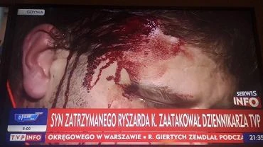 Operator TVP pobity przed domem Ryszarda K. 
