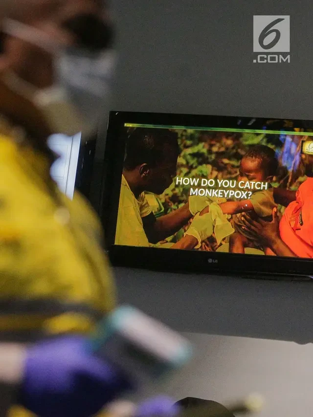 Sudah 55 Kasus Mpox di Indonesia per 21 November 2023, DKI Jakarta Terbanyak