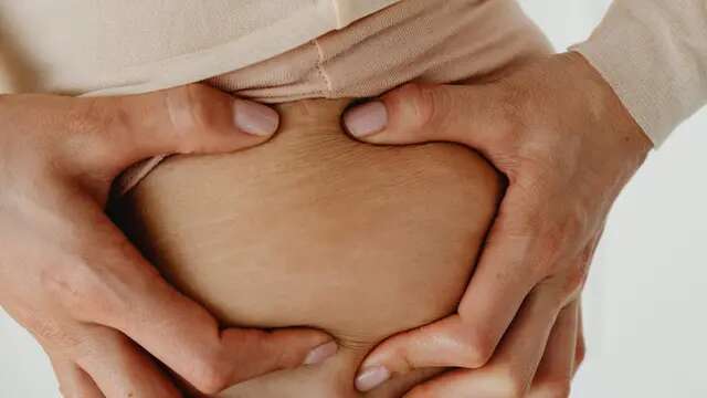 Cara Ampuh Hilangkan Stretch Mark pada Kulit dengan Alami