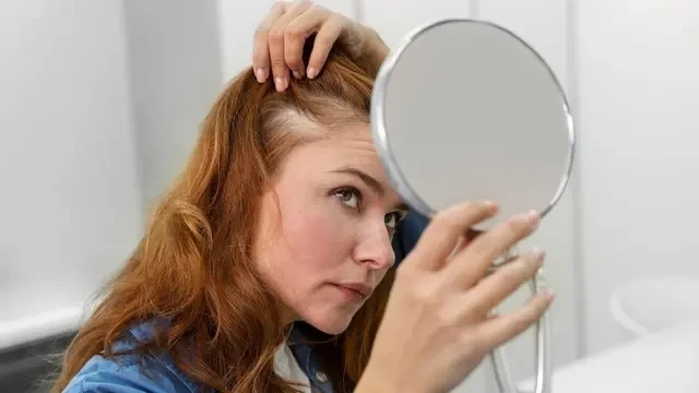 8 Hal yang Perlu Diperhatikan Sebelum Memutuskan untuk Transplantasi Rambut