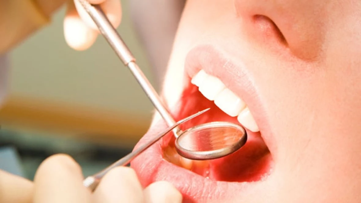 Dentists praise Canadian Dental Care program, but also express concern over influx of new patients