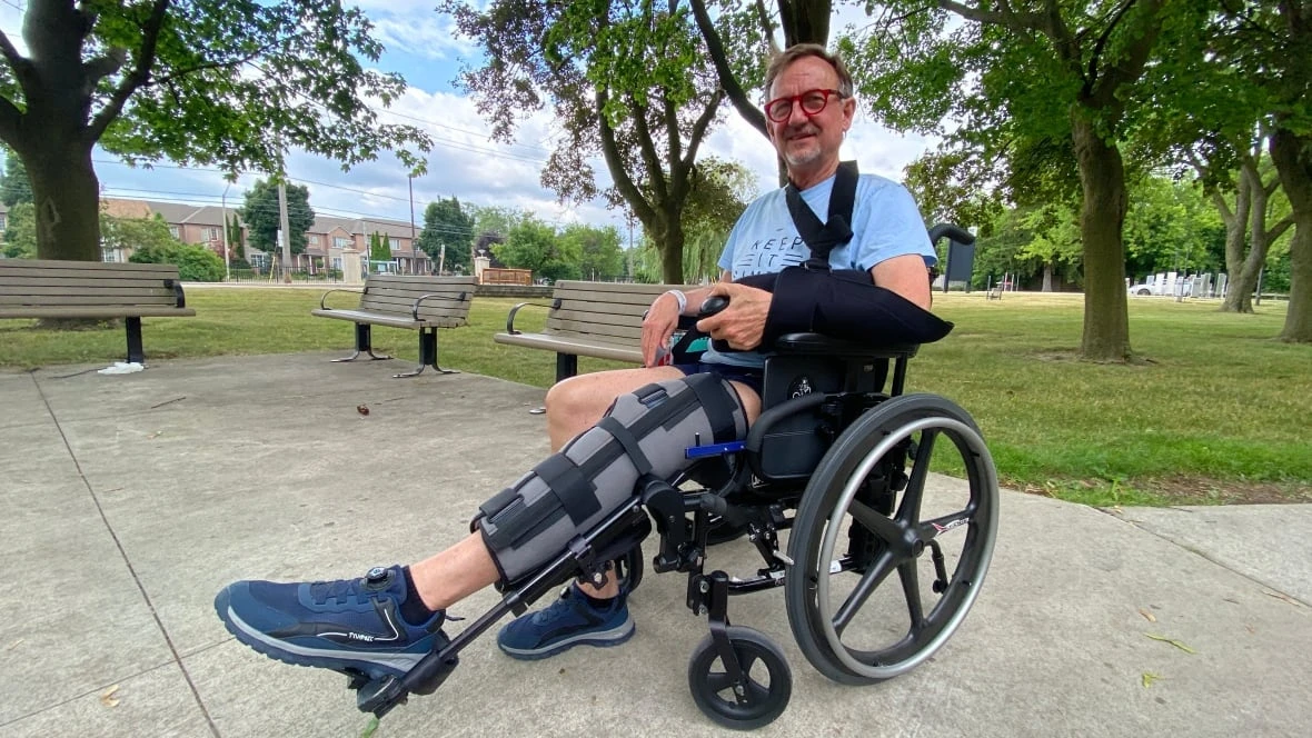 Toronto police took over an hour to respond to brutal assault, victim says
