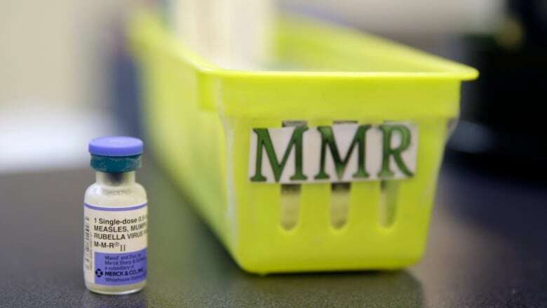 Number of confirmed measles cases in New Brunswick rises to 25