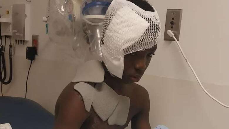 Montreal-area boy severely burned after stranger throws boiling water on him