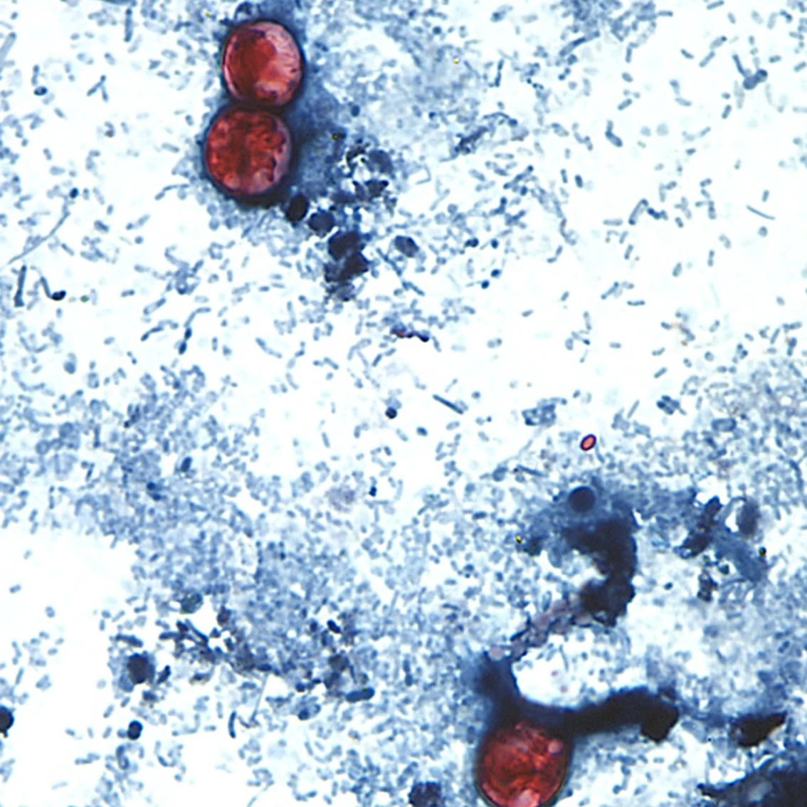 A diarrhea-causing parasite has infected more than 1,000 in the U.S. Is it in Canada?