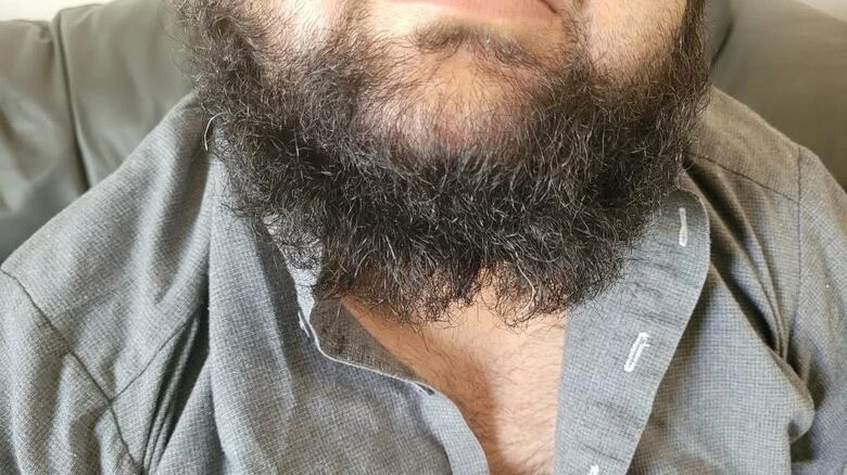 Saskatoon man says he was assaulted, had part of beard cut off in early morning racist attack