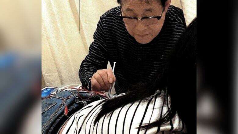 Rogue B.C. acupuncturist's unlicensed needlework captured by hidden camera