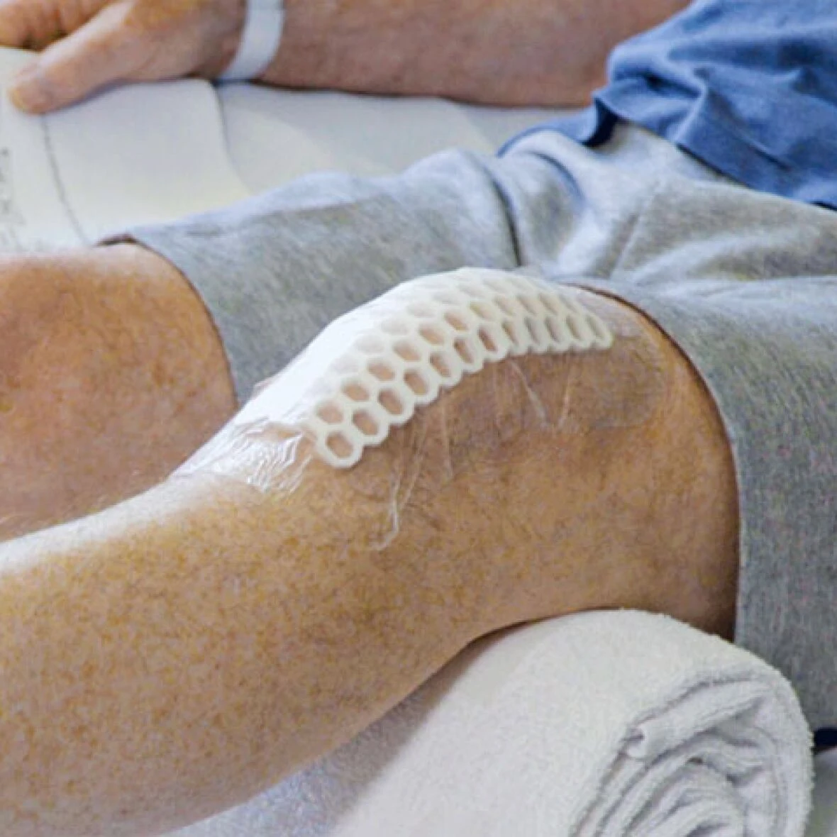 It's much faster to get hip or knee replacements if there's a central waitlist: study