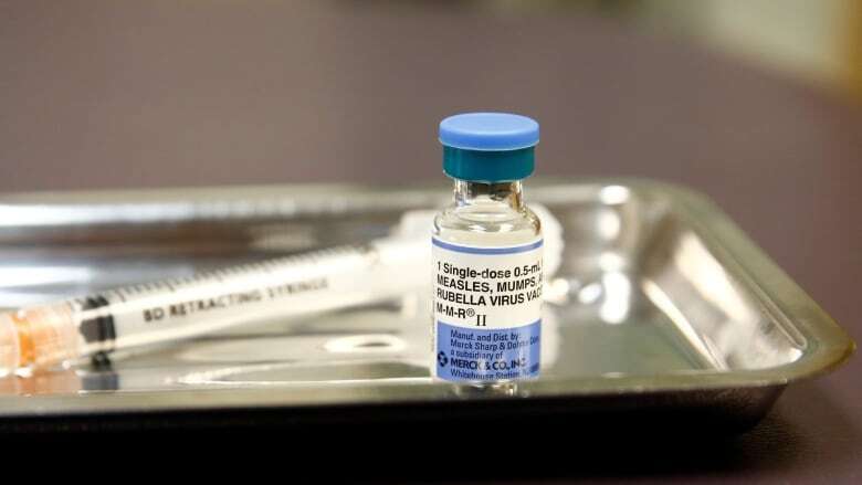 Measles outbreak confirmed in Hastings County