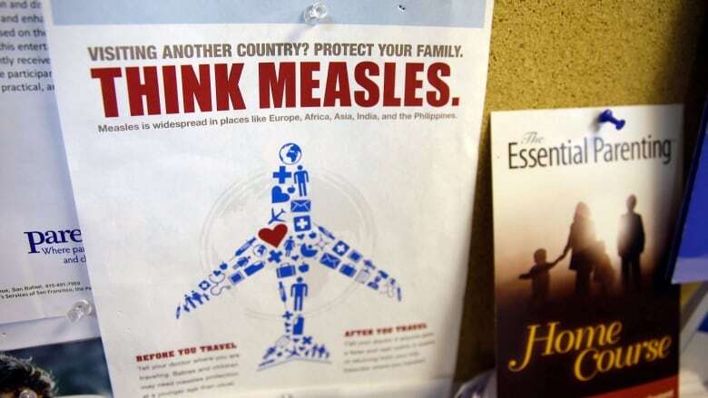 N.B.'s top doctor warns of March break measles risk