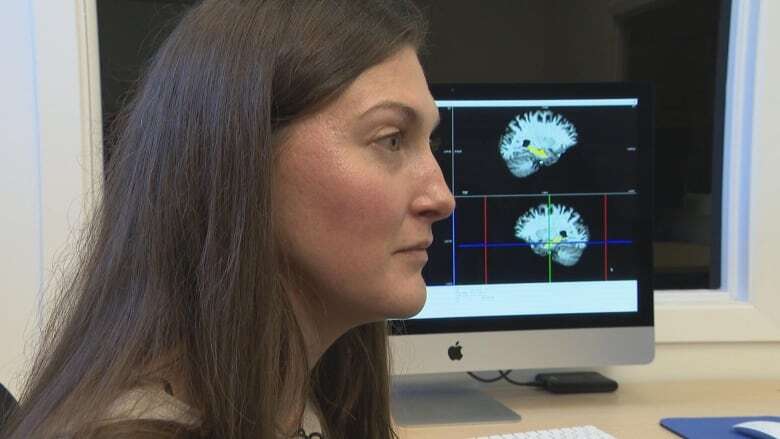 Is bilingualism good for your brain? Montreal researchers are seeing tangible results