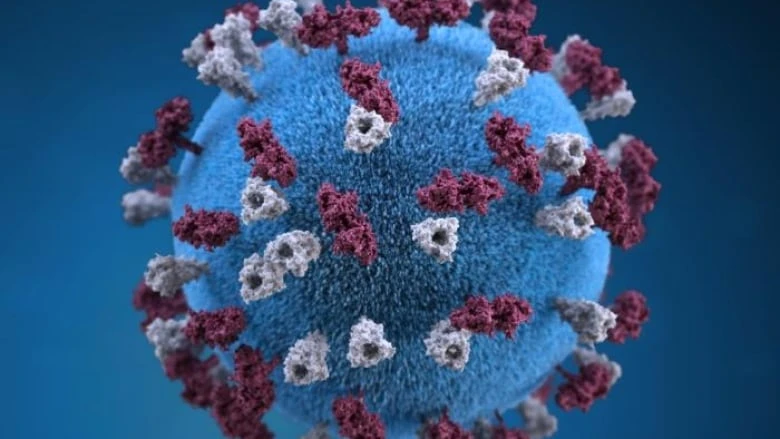 New potential measles exposure in southern Alberta including Calgary: AHS