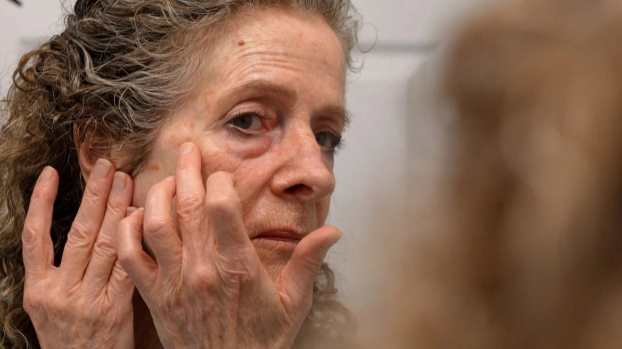 Dermatology wait times skyrocket in Canada — unless you want Botox