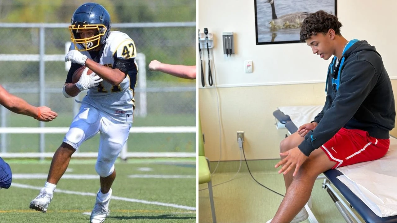 Youth knee surgeries are rising in Quebec. Here's how to prevent them