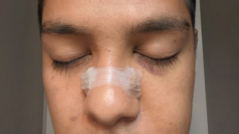 Toronto police lay charges following beating of man in Hanlan's Point