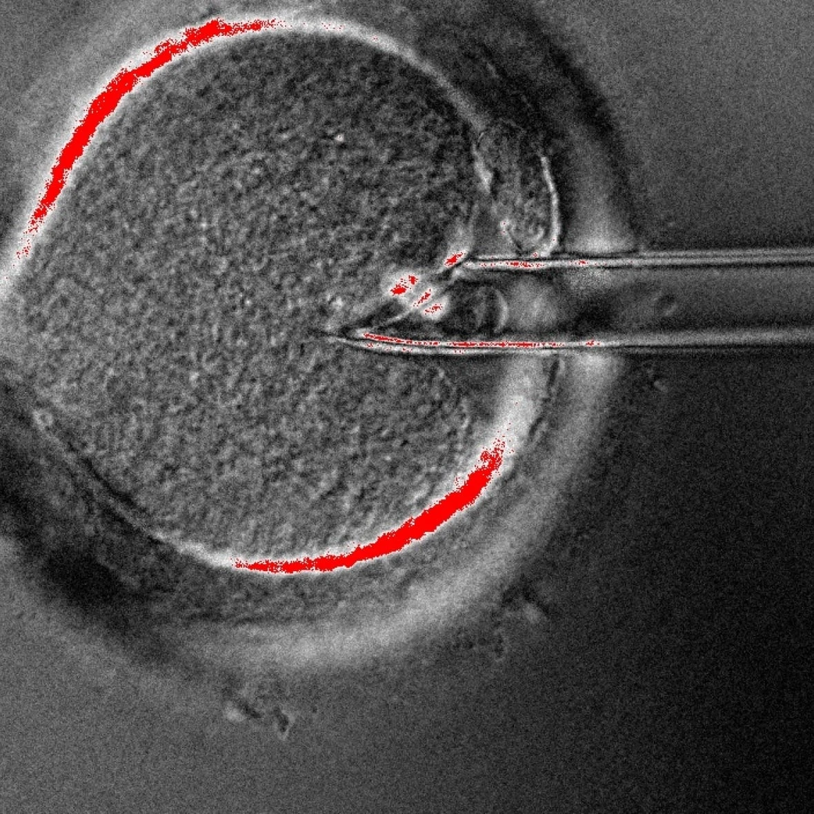 8 babies born with experimental 3-parent IVF technique