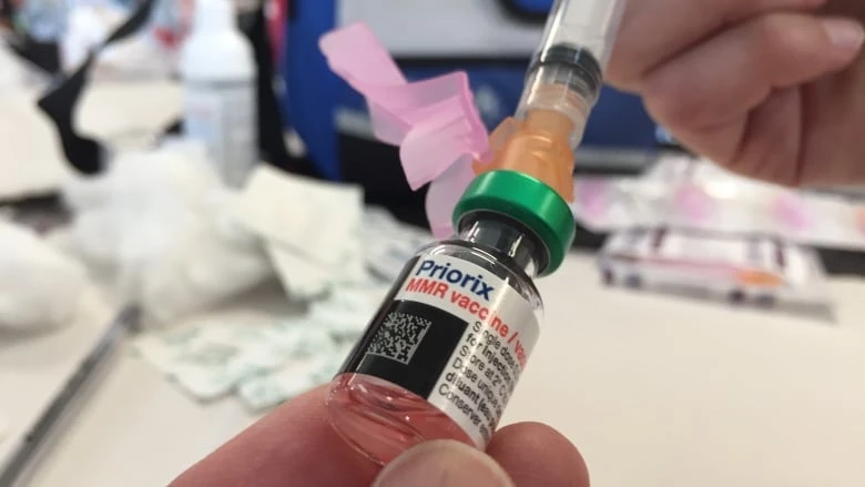 Health teams scramble to contain spread of measles in central and southern Alberta