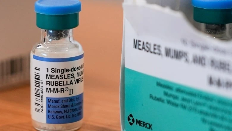 More potential measles exposures in Kingston, Belleville