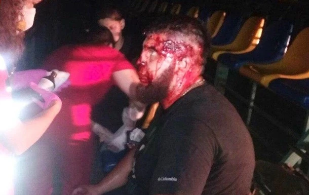 Під Києвом масова бійка закінчилася стріляниною - ЗМІ