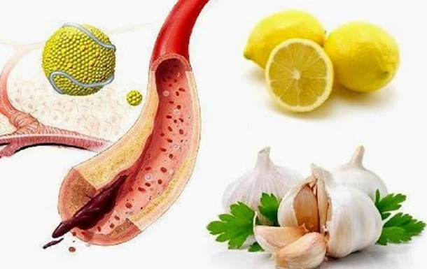 Названо топ-10 продуктів, що очищають артерії