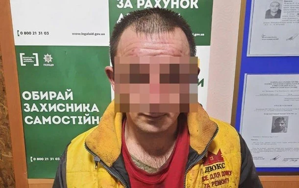 У Миколаєві чоловік облив кислотою дружину і двох дітей