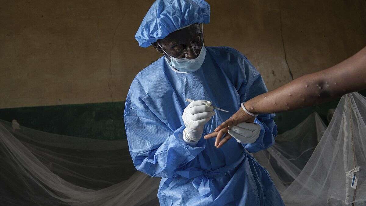 Variole: l'Alliance du vaccin livrera 500 000 doses aux pays africains