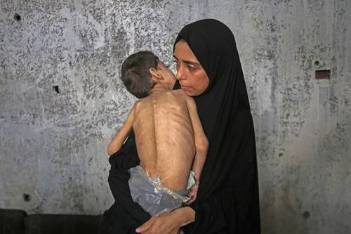 Netanyahu anuncia pausa humanitaria entre condenas por hambruna en Gaza   