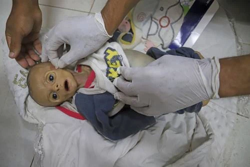Oficial, hambruna en Gaza; medio millón en etapa catastrófica: ONU   