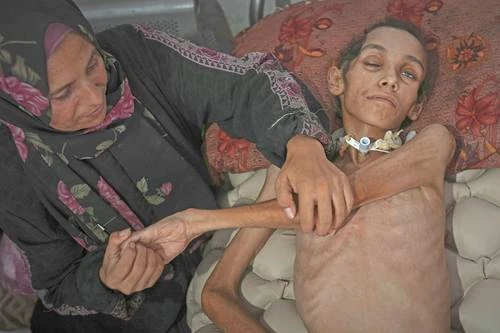 EU exalta labor de centro de ayuda, en donde han matado a cientos de gazatíes   