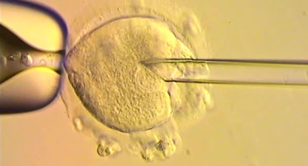 pochi secondi faNascere col DNA di tre personeNel Regno Unito otto bambini sono stati concepiti con due ovuli e uno spermatozoo per evitare malattie ereditarie