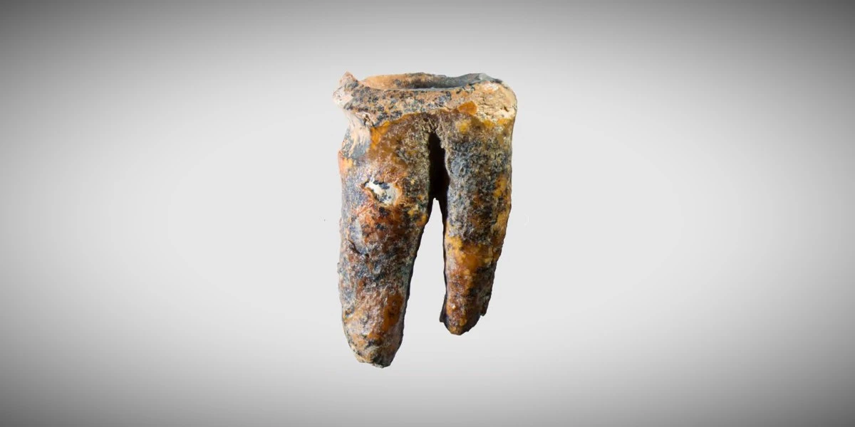 4 minuti faI Neanderthal furono i primi dentisti?Un dente che risale a 59mila anni fa ha un foro compatibile con un primordiale intervento dentale, ma non tutti sono convinti