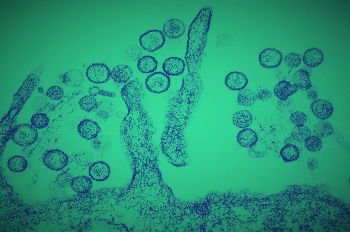 4 minuti faDov’erano gli hantavirus prima che li scoprisse tutto il mondoDa un fiume coreano fino alla casa di Gene Hackman, la storia di come li abbiamo scoperti, studiati e ci abbiamo avuto a che fare è sempre rimasta ai margini del dibattito