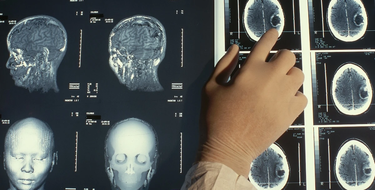 1 minuto faQuanto fidarsi delle AI per la nostra saluteSaranno sempre più usate per fare diagnosi e prescrivere terapie, ma che succede se si inventano malattie o parti anatomiche?