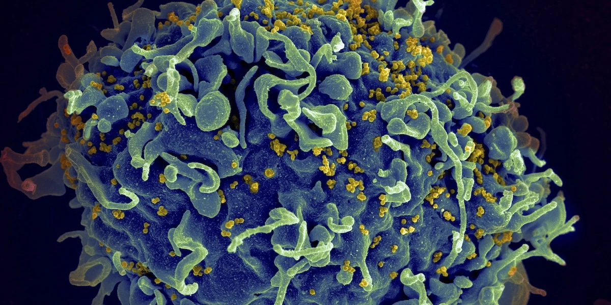 C’è un nuovo promettente studio sull’HIVSfrutta la tecnologia dell’mRNA, ma serviranno sperimentazioni e anni prima di arrivare a un'eventuale cura