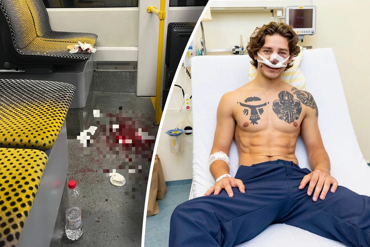 Er beschützte Frauen und wurde selbst zum Opfer: Jonathon über die Messer-Attacke in der Straßenbahn