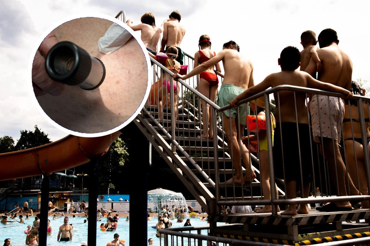 Gefährliche UV-Strahlen: Gratis Hautcheck für Neuköllner Freibad-Besucher!