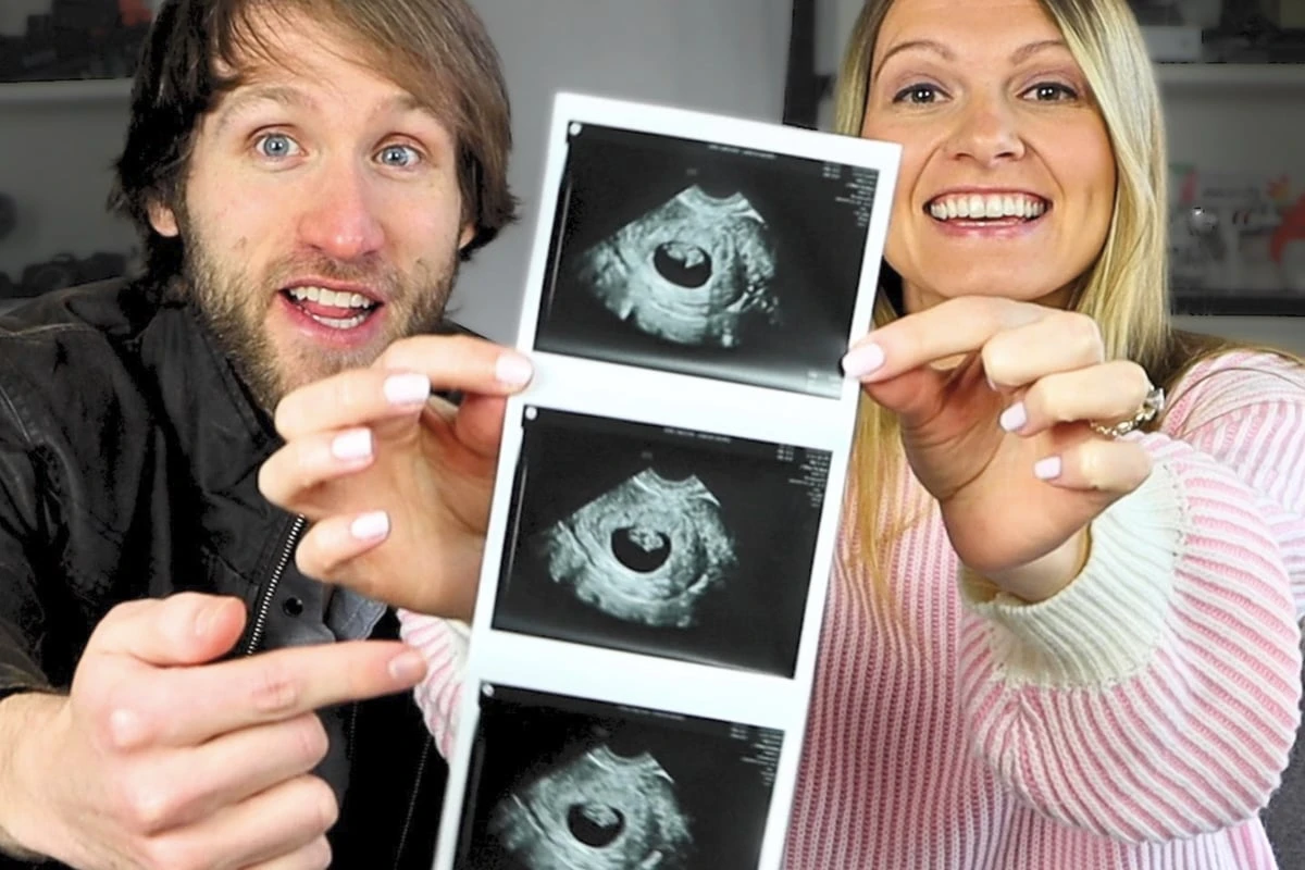 Abtreibung nach Down-Syndrom-Diagnose: YouTuber-Paar erhält Todesdrohungen