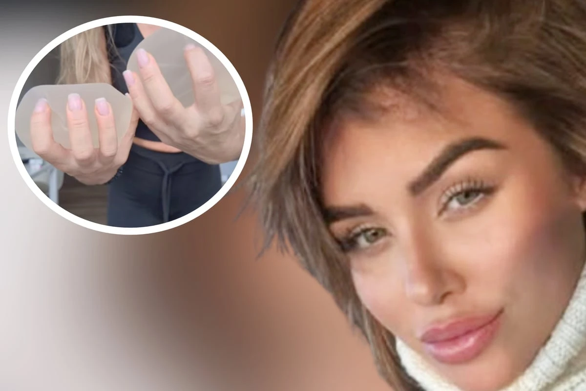 Kim Gloss lässt sich zum dritten Mal Brüste operieren: Doch es gibt Komplikationen