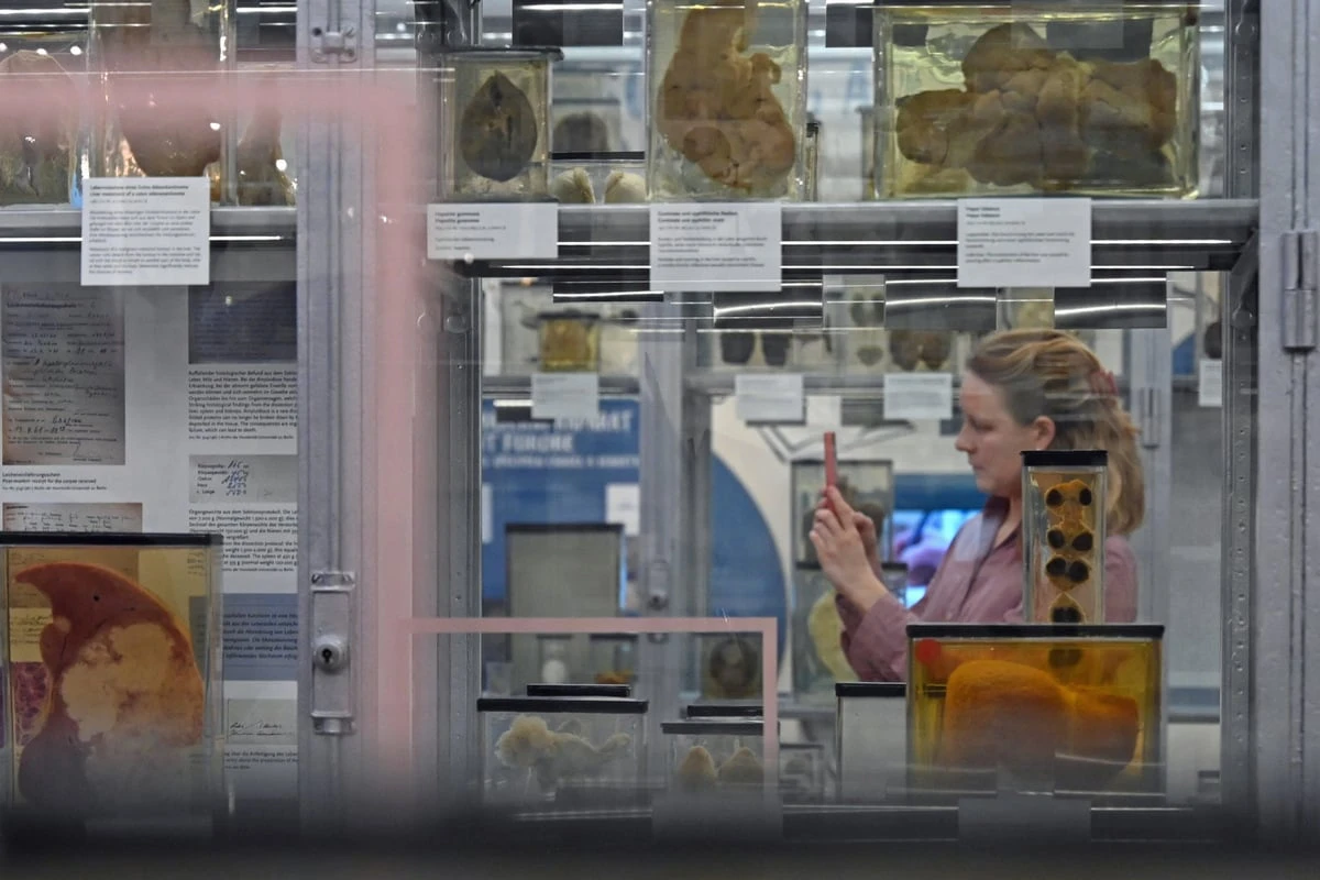 Ekel-Ausstellung in Berlin: Warum diese aber so wichtig ist