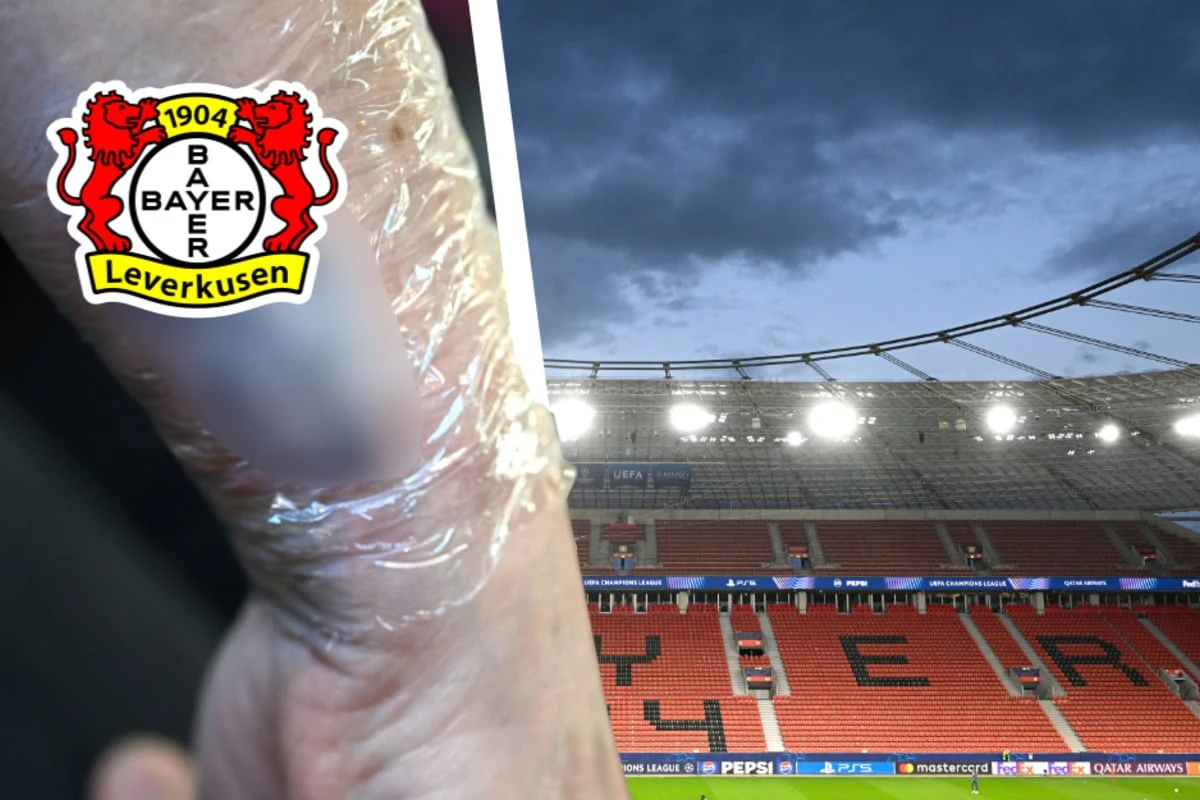 Besondere Aktion: Bayer Leverkusen spendiert Tattoos für guten Zweck