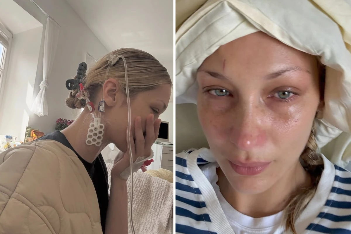 Abgekämpft und verheult im Krankenbett: Bella Hadid versetzt Fans mit Post in Sorge